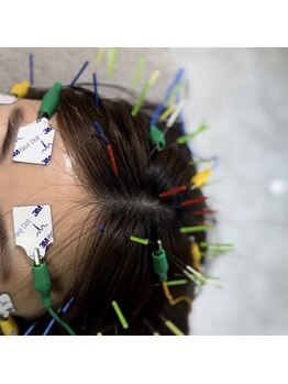 ハリオン 中目黒(HARI-ON)/頭の鍼で自律神経調整