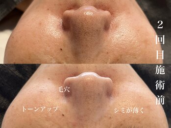 ダン(dan)/陶肌トリートメント【症例】