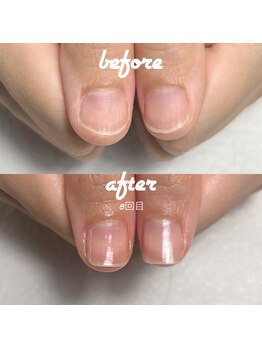 ネイルサロン ユーズ(USE.)/最強のネイルケアコース　last