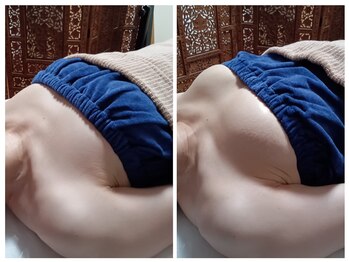 ミラクルバスト 松山店/ビフォーアフター１回施術