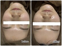 エンチャント(ENCHANT)/★マーメイド水素トリートメント