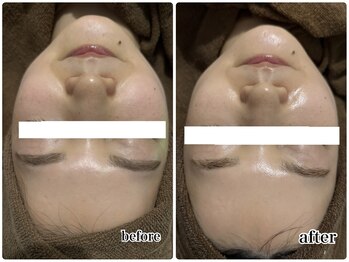 エンチャント(ENCHANT)/★マーメイド水素トリートメント