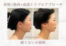 フロリール アザブジュウバン(FlorirAzabujuban)