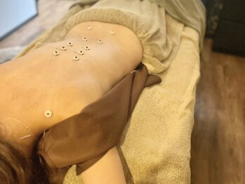 リラ鍼灸接骨院(Rela鍼灸接骨院)/全身しんきゅう