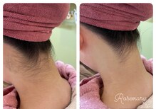 シェービング アンド エステ ローズマリー(Rosemary)