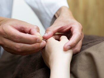 和鍼灸治療院の写真/【茅ヶ崎NEWOPEN】鍼灸で疲労解消！落ち着いたプライベート空間で、マンツーマンで丁寧に施術致します。