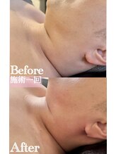 ジャミーラ(JAMIL)/◇脂肪燃焼フェイス　ビフォアフ