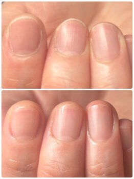 シェリージュ(cherieju)/ネイルケア