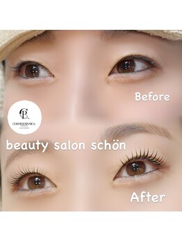 シェーン(schon)の写真/まつ毛が短い・少ない・下向きで悩んでいる…そんな方のためのお悩み解決サロン☆健康的な美まつ毛に♪