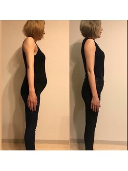 サクラサク鍼灸カイロプラクティック 日本橋茅場町院の写真/【ダイエットプラン】遺伝子検査を基におひとりおひとりに合わせた完全個別指導のダイエットプラン!