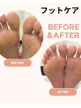 スペシャルフットケア　￥6000