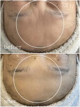 ブリエ 自由が丘(briller)/【生ヒト羊水幹細胞AC導入】