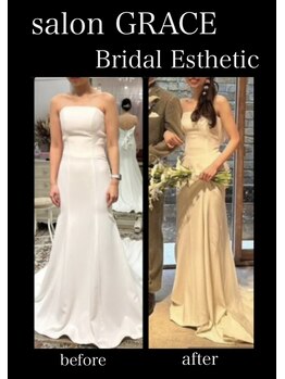 サロン グレイス(salon GRACE)/