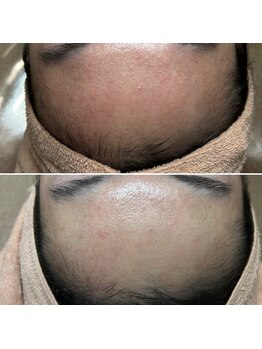 ルーチェエムベルシック(Luce.MBelChic)/超敏感肌のお悩み