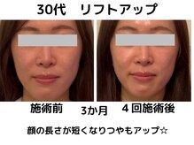 エンジェルエッグ/◆顔の長さが変わる！