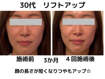 エンジェルエッグ/◆顔の長さが変わる！