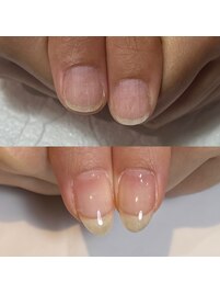 もたないジェルのお悩み解消