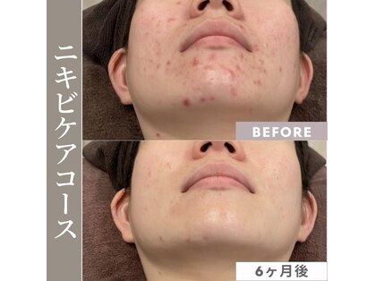 サードプレイス(3rd Place)の写真