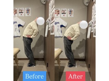 ナオル整体 宮崎院(NAORU整体)/30代男性施術事例【反り腰改善】