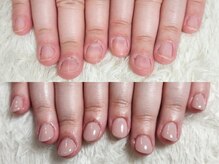 グラシナ なんば店/深爪/自爪育成/フィルイン