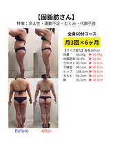 ダイヤモンドトゥルース(Diamond truth)/長年溜め込んだセルライトも解消