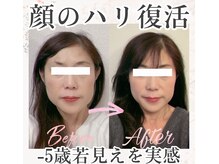 アシュネ(Axiune)の雰囲気(たるみ,ほうれい線,浮腫みなど、大人女子のお悩みを徹底解消!)