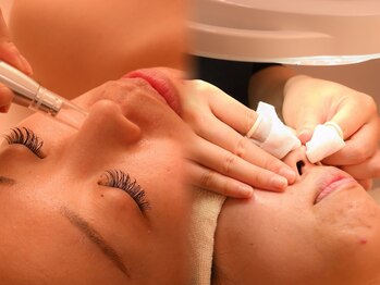 セレソル(CERESOL)の写真/【毛穴専門×オーダーメイド洗浄】“整えながら美しくする”CERESOL独自の毛穴ケア