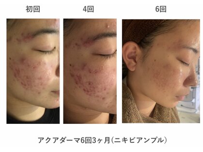イエナ(IENA)の写真