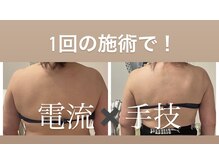 エステスタジオ アキコ(AKIKO)