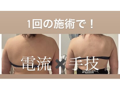 エステスタジオ アキコ(AKIKO)の写真