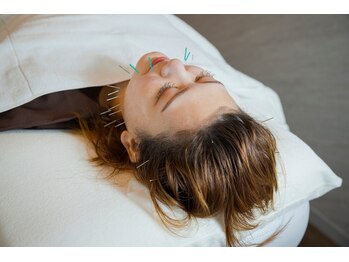 デルタエヌピー63+(δnp63+)/お客様施術例【小顔/薬院/福岡】