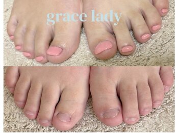 グレースレディ/2時間後には綺麗に