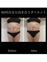 レミュー/レミューダイエット症例