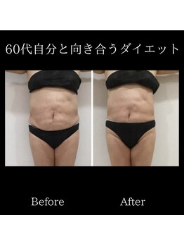 レミュー/レミューダイエット症例