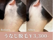 ダリア(DAHLIA)の雰囲気（最先端マシンを使用したハイパワー脱毛！安心の都度払い制も◎）
