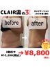 【1番人気】痩身3ステップ1時間かけ放題¥13,200→¥8,800【今月激アツ】