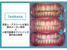 ロンハナ(lonhana)