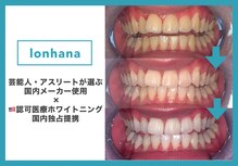 ロンハナ(lonhana)