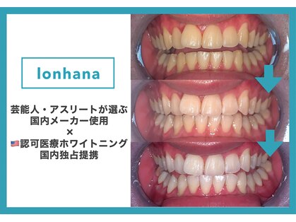 ロンハナ(lonhana)の写真
