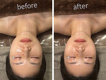 エムズプレミアム(M’s Premium)/小顔効果について