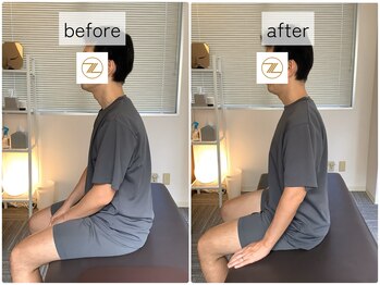 ゼン骨盤整体院(ZEN骨盤整体院)/【40代男性】首肩こり