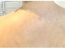 香嬉琉/更年期の火照りにも♪