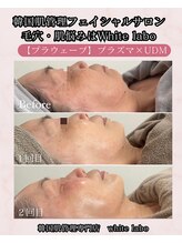 ホワイトラボ 梅田(White labo)/【プラウェーブ】プラズマ×UDM