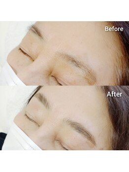 マツ(MATSU)/【ハリウッドブロウリフト】