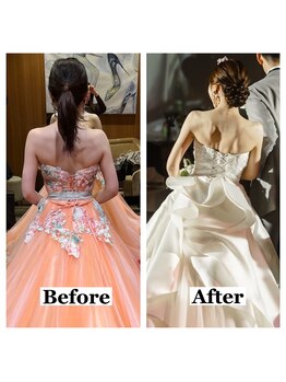 ライズ/お客様のビフォーアフター