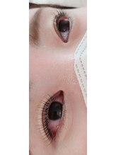 コア(Koa)/さらに美しい目元にパリジェンヌ