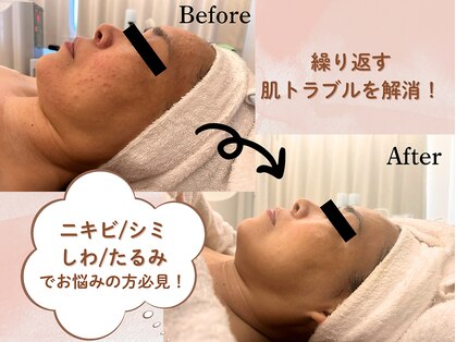 カオン(kaon)の写真