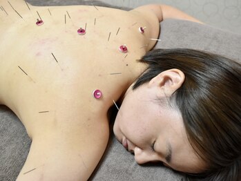 ドリームメディカルスタイル(Dream Medical Style)の写真/≪根本改善サロン≫一流女性鍼灸師×個室施術★鍼灸/美顔鍼/整体etc男女,ペアOK！疲労改善&美肌&小顔も◎