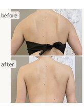 ビオラ(美ola)/筋膜リリースでメリハリボディ♪