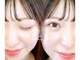 アイラッシュサロン ブラン Lty草津店(Eyelash Salon Blanc)の写真/【印象爆上げセット！マツエク×アイブロウが大人気！！】フラットラッシュで今っぽ目元にグッと格上げ◎